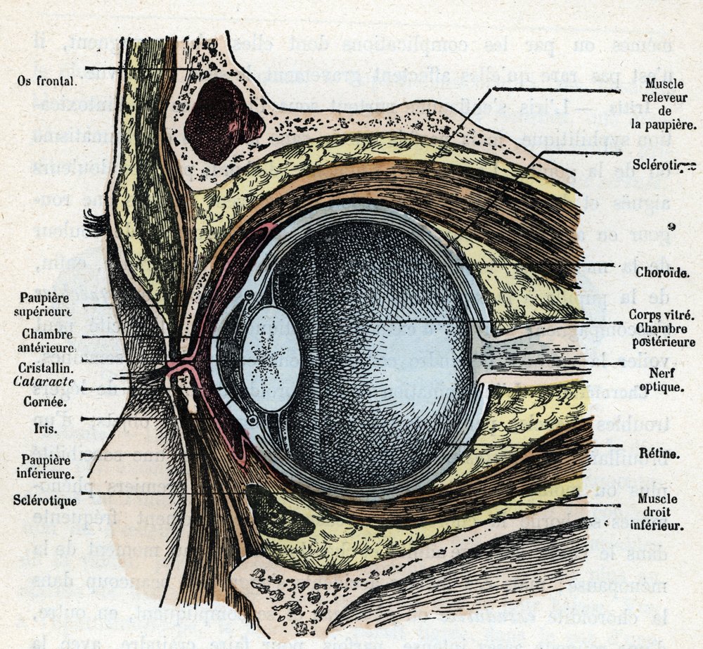 Danive Katarakt Augenmodell - Anatomiemodell Für Medizinunterricht Und Arztpraxen