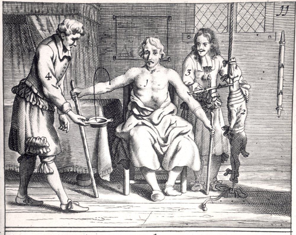 Bluttransfusion von einem Hund, aus „Armamentarii Chirurgici“ von Johannes Schultes (1595-1645), veröffentlicht in Amsterdam, 1671 von Dutch School