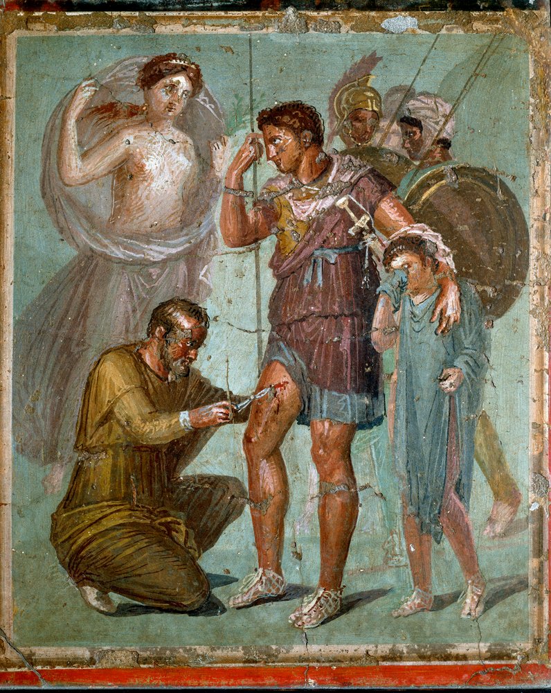 Der verwundete Aeneas wird in Begleitung seines Sohnes Iulus von dem griechischen Arzt Iapyx, Sohn des Iasus, behandelt. Römisches Fresko aus dem 1. Jahrhundert n. Chr. aus Pompeji. Neapel, Archäologisches Nationalmuseum - Römische Kunst: Der verwundete von Roman
