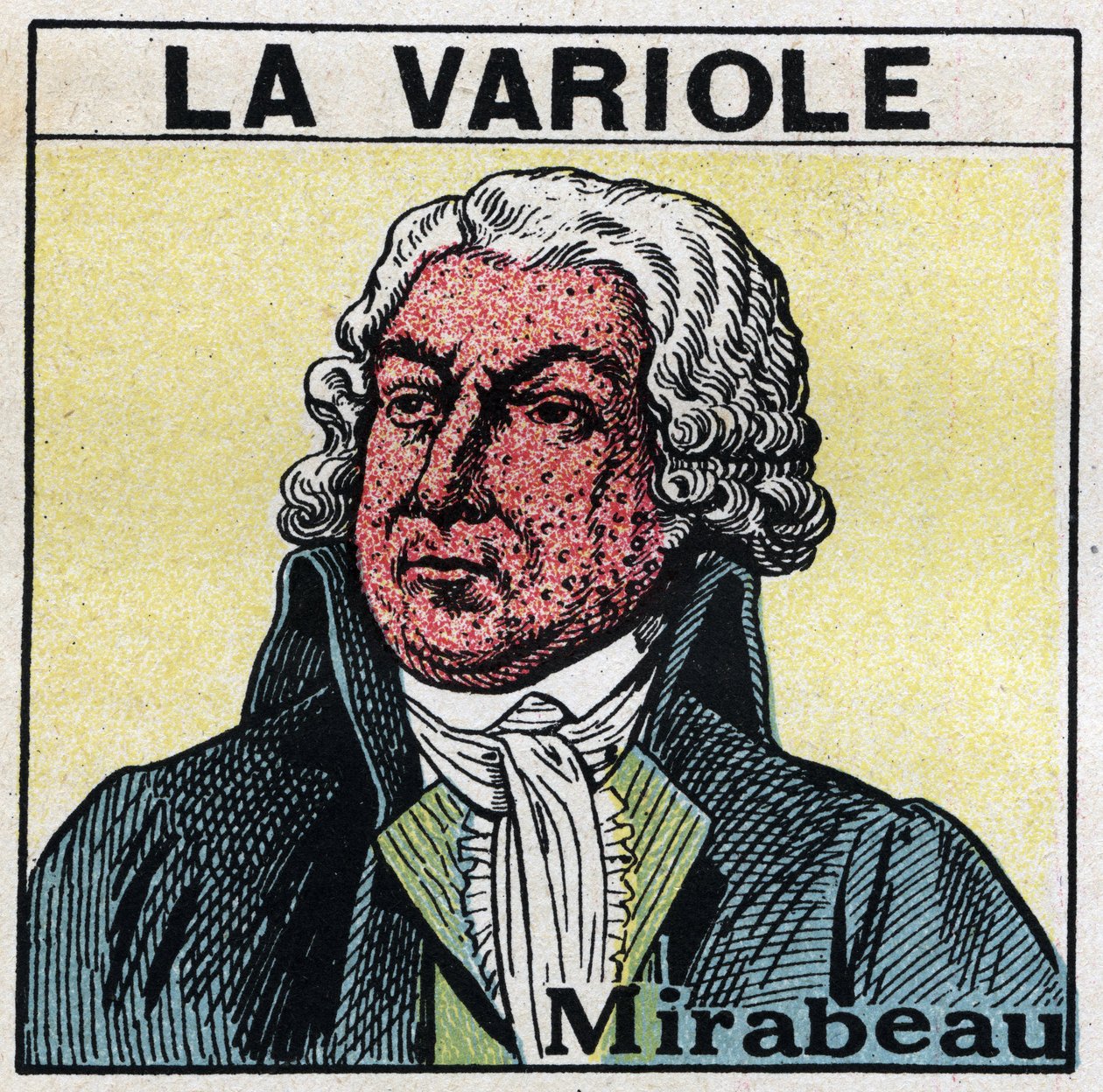 Porträt von Honore Gabriel Riqueti, Graf von Mirabeau mit Pockennarben im Gesicht. Anonyme Illustration. von Anonymous Anonymous