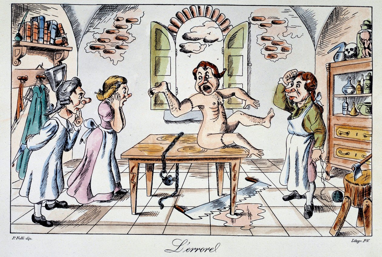 Chirurgischer Fehler: ein satirischer Aufkleber, der die Risiken darstellt, denen Patienten ausgesetzt sind, die in die Hände schlechter Ärzte geraten, ein Beispiel für eine Armtransplantation anstelle des Beins. Gravur des 19. Jahrhunderts Privatsammlung von Anonymous Anonymous