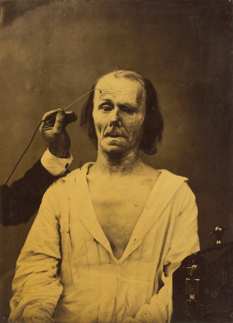 Ein entspanntes Gesicht links, tiefe Aufmerksamkeit rechts, 1854-1856, gedruckt 1862 von Duchenne de Boulogne