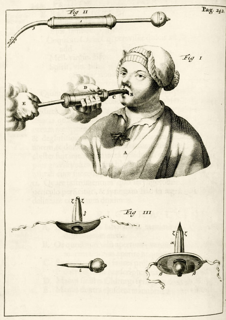 Verwendung einer Spritze zur Verabreichung eines Abführmittels, aus Exercitationes Practicae circa Medendi Methodum von Frederik Dekkers, 1694 von Dutch School