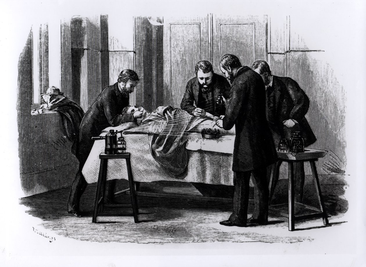 Antiseptische Chirurgie, 1882 von English School