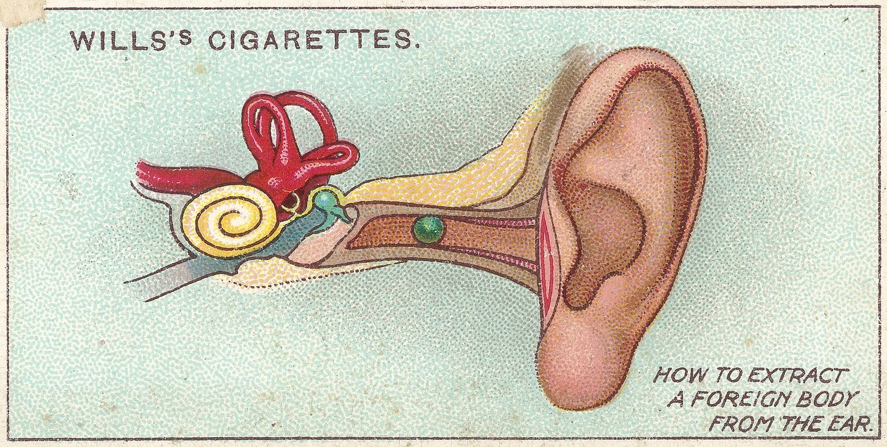 Fremdkörper im Ohr, Nr. 30 aus der Erste-Hilfe-Serie von Willss Zigarettenkarten, 1913 von English School