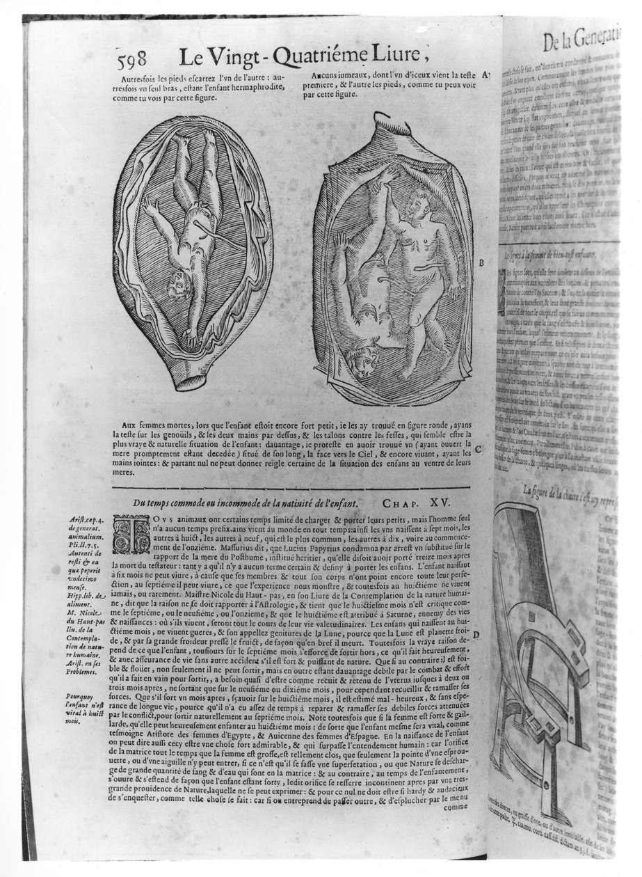 Fötus, Illustration aus Oeuvres von Ambroise Paré (1509-90), veröffentlicht in Lyon, 1641 von French School