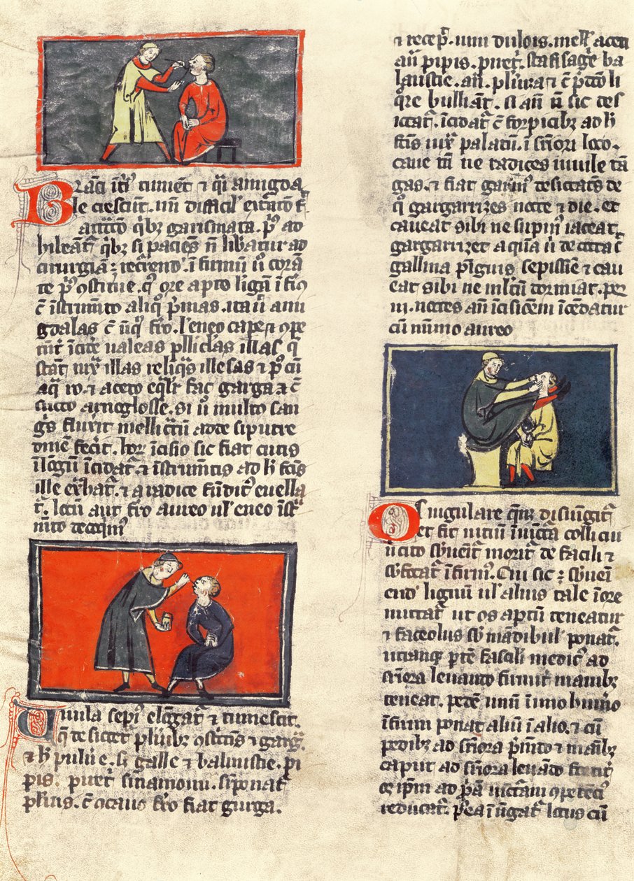 Ms H 89 fol.16v Zahnchirurgie, aus einer Ausgabe des 