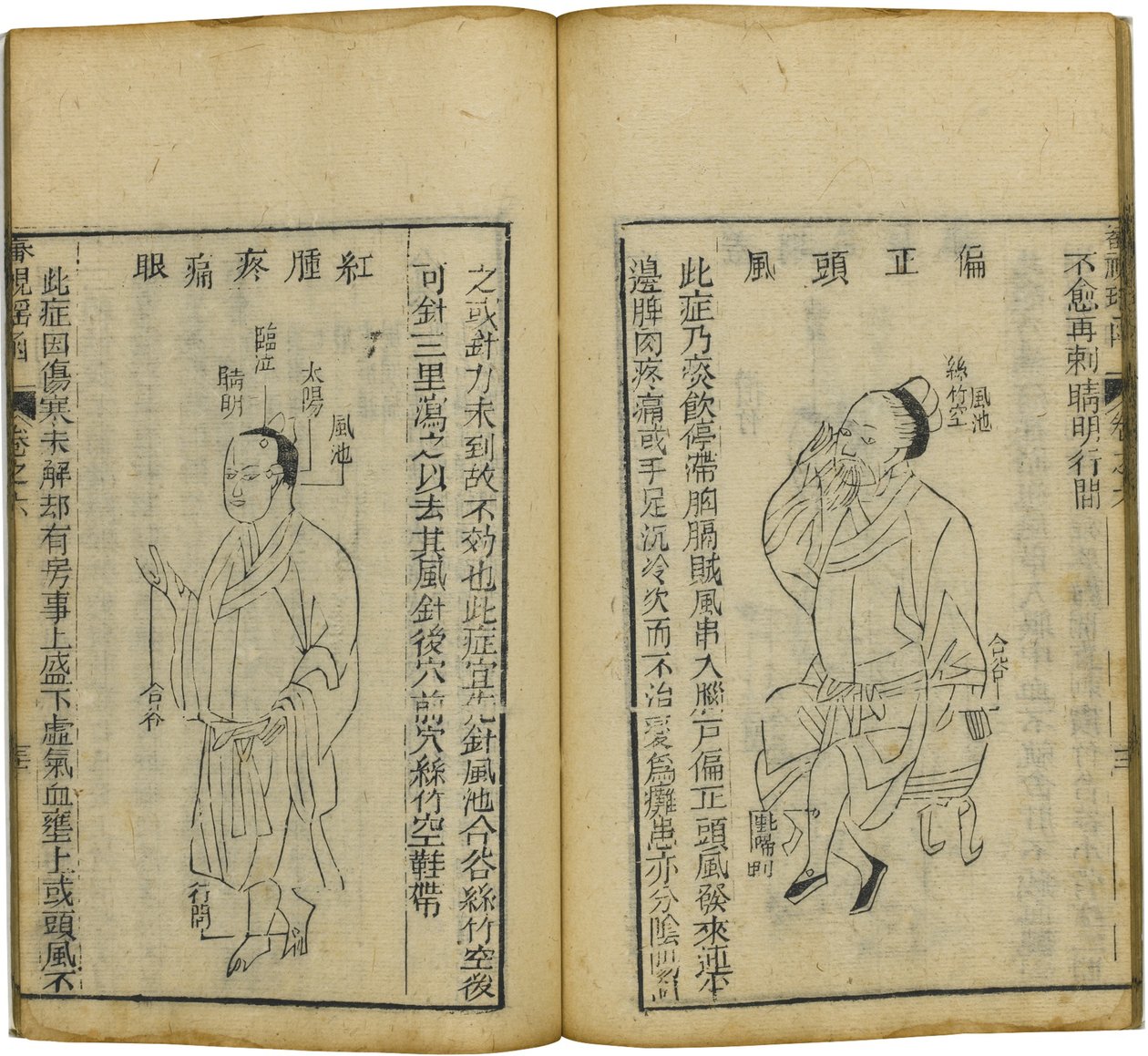 Shen Shi Yao Han Ein kostbares Buch der Augenheilkunde, 1644 von Fu Renyu
