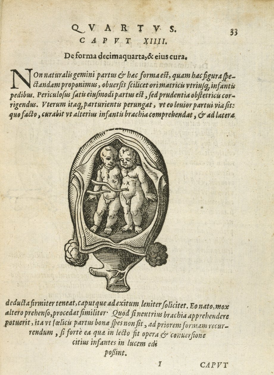 Nicht-identische Zwillinge im Mutterleib, Illustration aus Kapitel 14, Buch 4 von Über die Empfängnis und das Wachstum des Menschen von Rueff, 1587 von German School