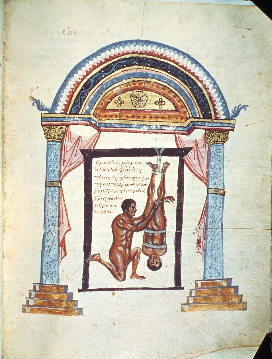 Behandlung einer Luxation, aus einem Kommentar von Apollonius von Citium (1. Jahrhundert v. Chr.) zum hippokratischen Traktat 