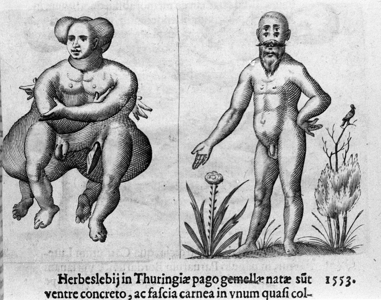 Verschiedene Arten menschlicher Monster. Stich aus „De monstrorum natura, causis et differentiis“ von Fortunio Liceti (1577-1656), italienischer Wissenschaftler. 1646 von Italian School
