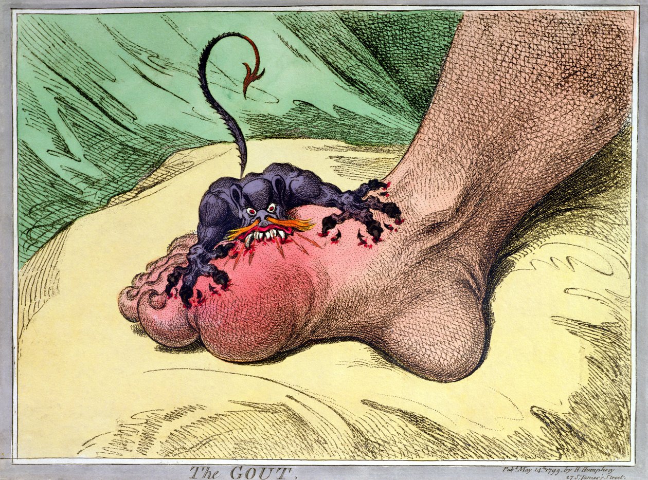Die Gicht, veröffentlicht von Hannah Humphrey 1799 von James Gillray