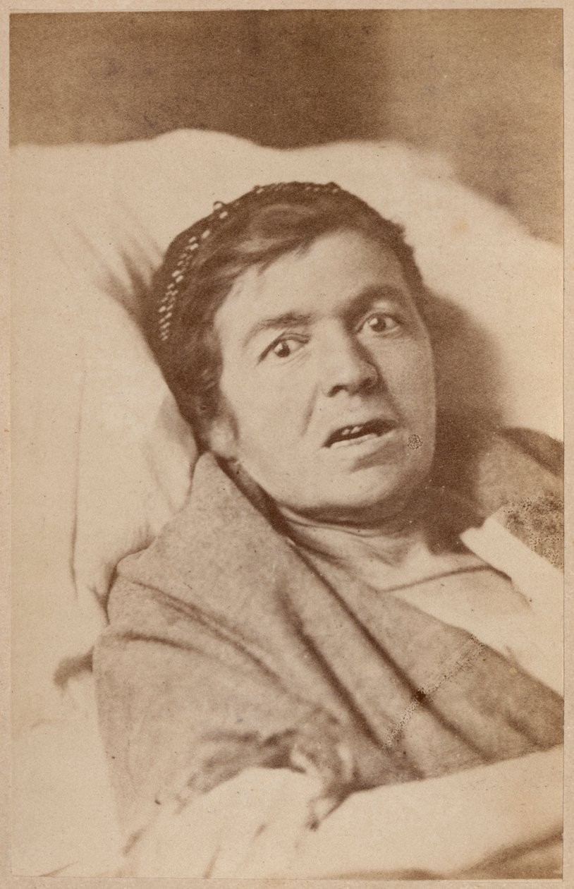 Hysterische Epilepsie, Gesichtskontraktion, Platte VIII aus 