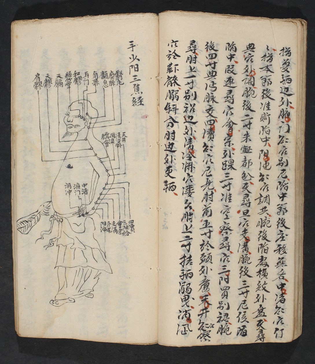 Akupunkturpunkte am Arm, Nacken und am Kopfansatz, aus Jing Guan Qi Zhi, 