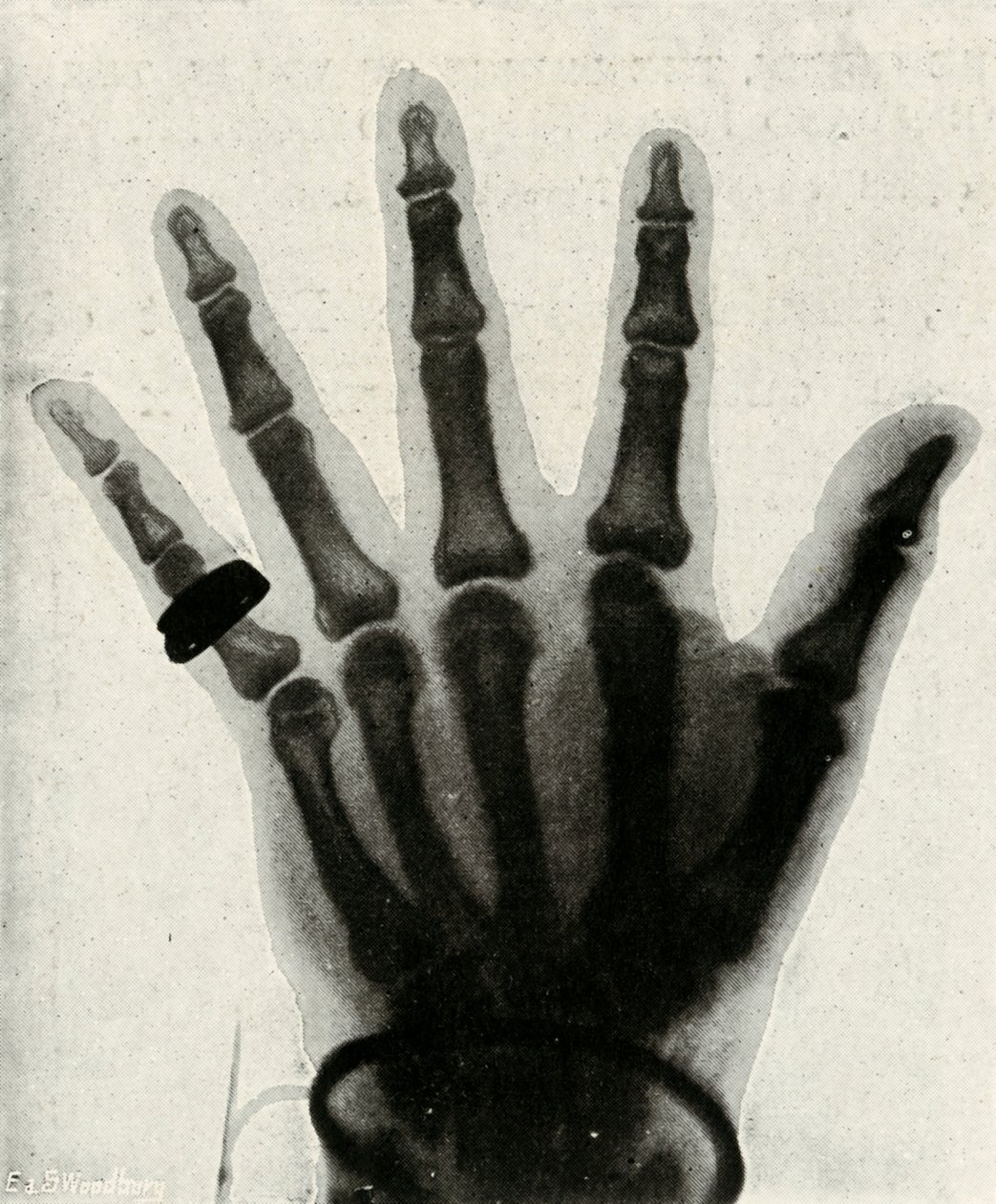 Röntgenaufnahme der Hand von H.R.H. Der Prinz von Wales von Unbekannt