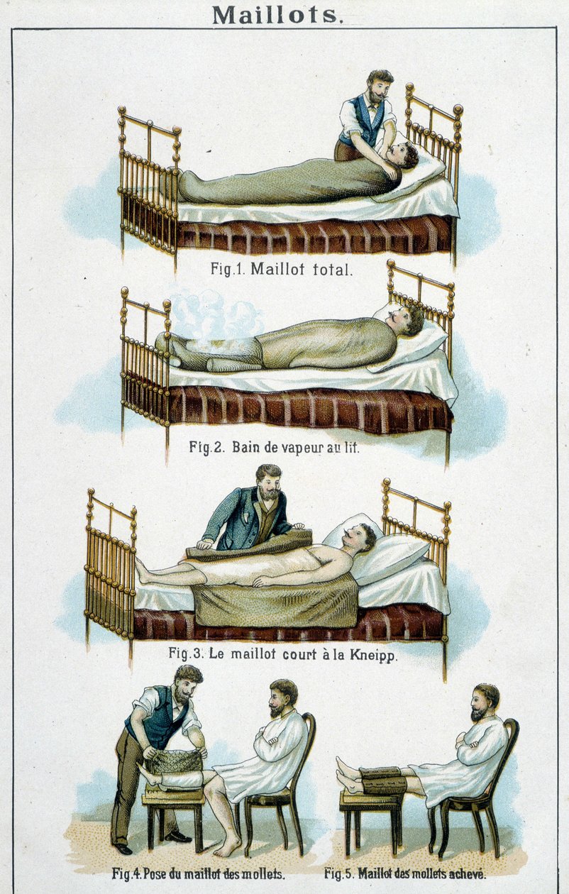 Trikots: 1) Ganzkörpertrikot, 2) Dampfbad im Bett, 3) Kneipp-Kurztrikot, 4-5) Waden-Trikot - in „Bilz, Naturheilkunde“, Ende des 19. Jahrhunderts von Unknown artist