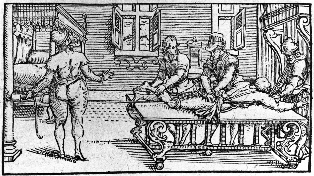 Reduktion einer Luxation, in „Traitè Médical“ von Ambroise Paré, um 1560 von Unknown artist