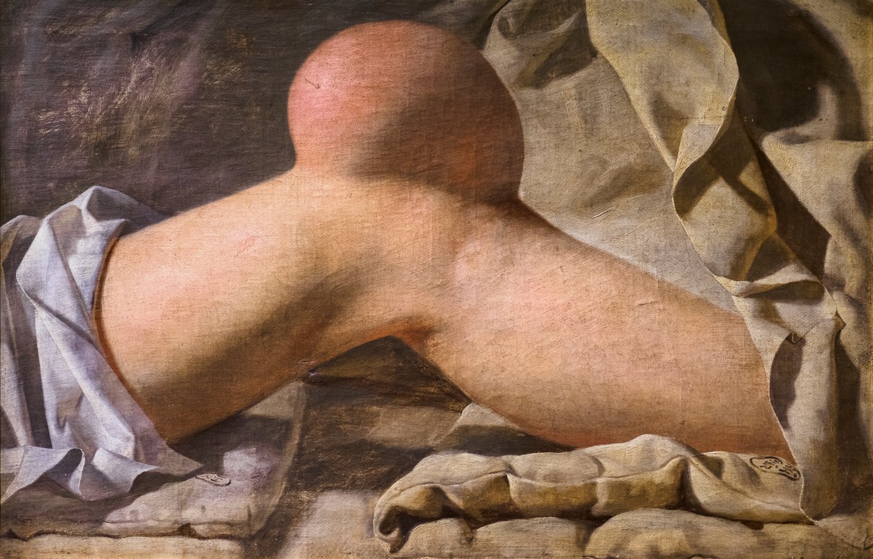 Eine Schwellung in der Region Patellaris [Knie] von Wilhelm Ferdinand Bendz