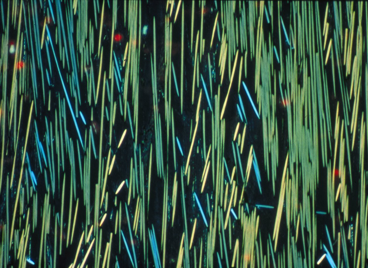 Verbundwerkstoff, LM PMC Kohlefaser in einer Polymermatrix von Frederick (attr. to) Barnard