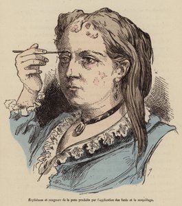 Frau mit Hautausschlägen und Rötungen durch die Verwendung von Make-up