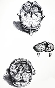 Die Platten aus dem siebten Buch der De Humani Corporis Fabrica von Andreas Vesalius