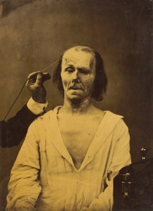 Ein entspanntes Gesicht links, tiefe Aufmerksamkeit rechts, 1854-1856, gedruckt 1862 von Duchenne de Boulogne