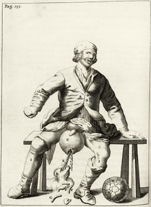 Abfluss von Flüssigkeit aus einem Hydrozele des Hodensacks, aus Exercitationes Practicae circa Medendi Methodum von Frederik Dekkers, 1694 von Dutch School