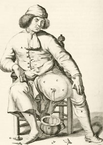 Abfluss von Flüssigkeit aus einem Abszess, aus Exercitationes Practicae circa Medendi Methodum von Frederik Dekkers, 1694 von Dutch School