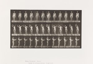 Tafel 557. Lokale Chorea; A, B, C, im Stehen, 1885