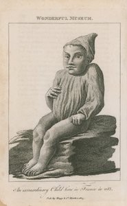 Ein außergewöhnliches Kind, geboren in Frankreich im Jahr 1683 von English School