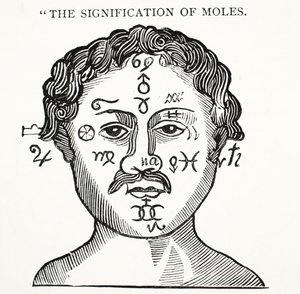 Die Bedeutung von Muttermalen, Illustration aus Chap-books of the Eighteenth Century von John Ashton, veröffentlicht 1882 von English School