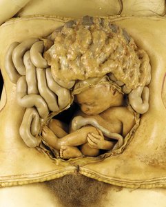Anatomisches Modell einer Eierstockschwangerschaft (Detail)