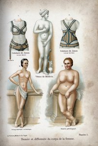 Schönheit und Deformität des Frauenkörpers: eine zu dünne und eine fettleibige Frau unter der Venus von Medici, als „ideale Frau“ betrachtet