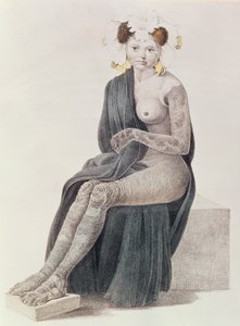 Kongenitale Ichthyose, aus einem Buch von G.M. Olbers, 1830
