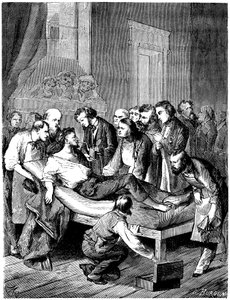 Erste chirurgische Operation mit Schwefelätheranästhesie im Boston Hospital, durchgeführt am 16. Oktober von French School