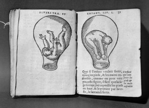 Fötus im Mutterleib, Illustration aus dem sogenannten Rhodion-Manuskript von French School