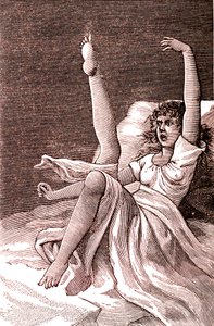 Hysterie, ein extrem mentales Phänomen, Psychosen und Psychoneurosen. 1887 (Gravur)
