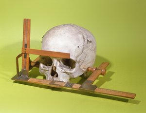 Schädel in einem Gesichtsgoniometer, konstruiert von Paul Broca (1824-88)