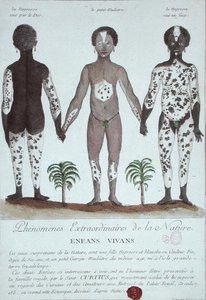 Das Phänomen der Leukodermie von French School