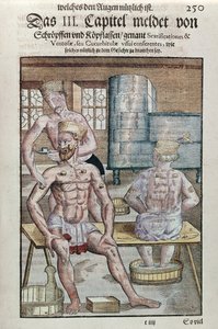 Schröpfen, aus Ophthalmodouleia von Georg Bartisch (1535-1636) veröffentlicht in Dresden 1583 (Farbholzschnitt)