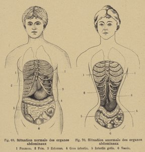 Normale Lage der inneren Organe des Bauches bei Männern und Frauen von German School