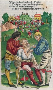 Entfernung eines Pfeils, Illustration aus Feldtbuch der Wundartzney von Hans von Gersdorff, 1540 von German School