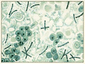 Anthrax-Bakterien im Blut, ca. 1890 von German School
