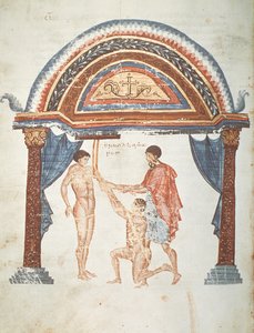 Behandlung einer Luxation, aus einem Kommentar von Apollonius von Citium (1. Jahrhundert v. Chr.) zum hippokratischen Traktat Über Gelenke