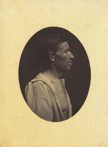 Ein Porträt, im Profil gesehen, eines 42-jährigen Mannes, betäubt durch Alkoholmissbrauch; seine Nase ist aquilin von Guillaume Benjamin Amant Duchenne