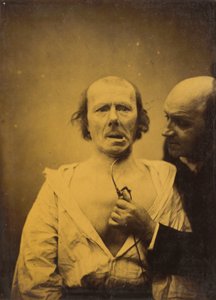 Diese Kontraktion des M. platysma allein fehlt Ausdruck