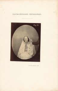 Électro-Physiologie Photographique, Abbildung 76