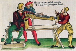 Apparat zur Heilung von Armbrüchen, Illustration aus dem 