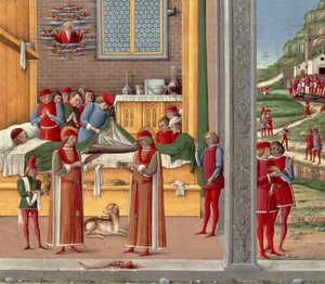 Mittelalterliche Amputationsszene von Italian School