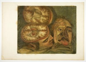 Schädelpräparation, Tafel fünf aus Anatomie des Kopfes, in Gedruckten Gemälden